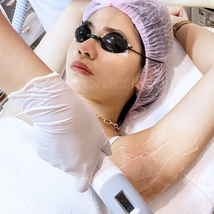 Underarm laser hair removal treatment in progress at J Young Clinic Asok