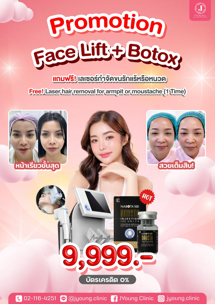 โปรแกรม Face Lift ผสาน Botox Nabota 100 Units แท้ ยกกระชับกรอบหน้าและลดกราม โดยเจยัง คลินิก