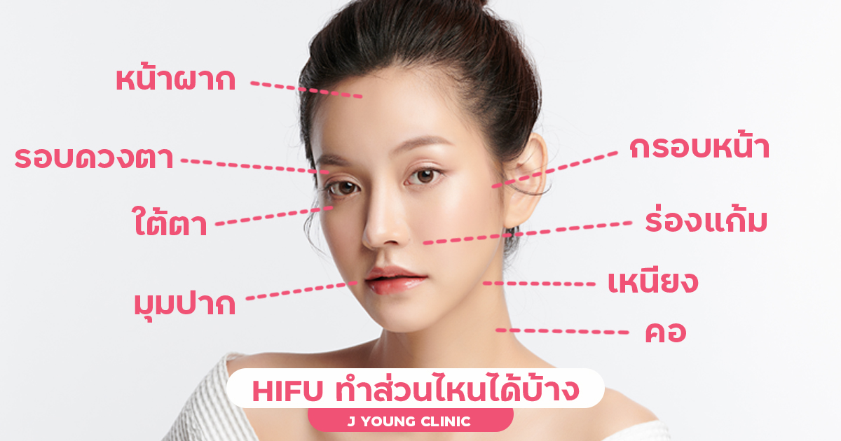 Hifuคืออะไร ปรับหน้าเรียวได้จริงไหม