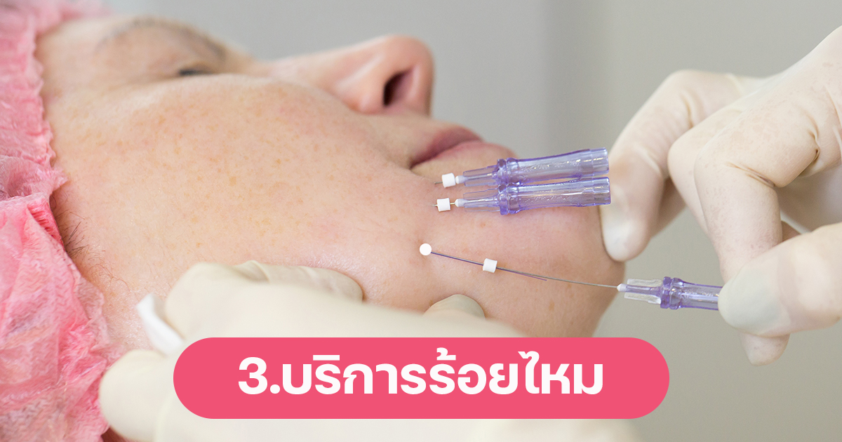 ร้อยไหม thread lift