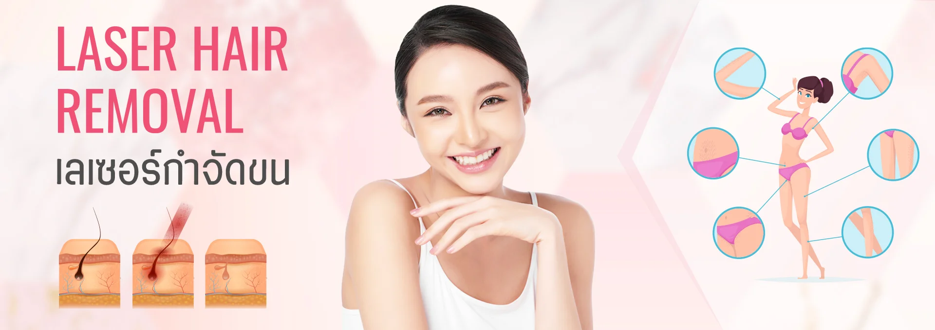 เลเซอร์กำจัดขน นวัตกรรมทำลายรากขนด้วยพลังงานเลเซอร์จำเพาะ